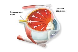 Схематическое изображение глазного давления